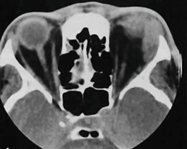 От температуры может болеть спина