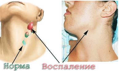 От температуры может болеть спина