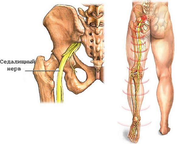 Седалищный нерв