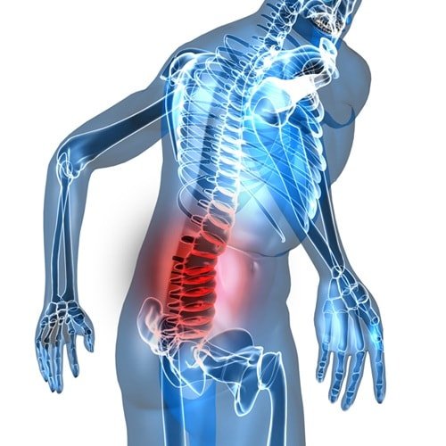 Болит поясница: причины у женщин