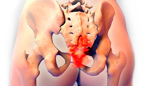 Когда сижу или лежу на спине болит копчик