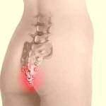 Болит спина в области копчика к какому врачу идти