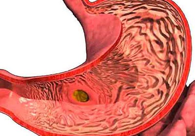 Болит голова спина живот тошнит