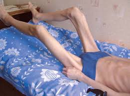 Болит спина у подростка к какому врачу