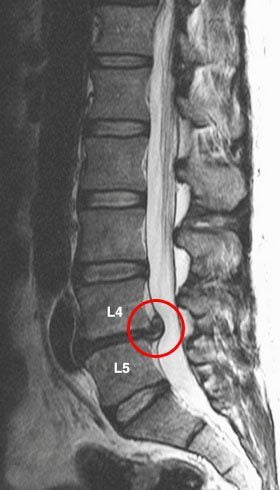 Что делать если болит правая спина