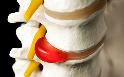 Сильно болит шея спина рука