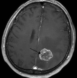 болит голова и слабость во всем теле