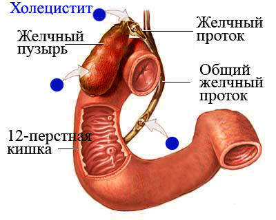 рвота болит правый бок и спина