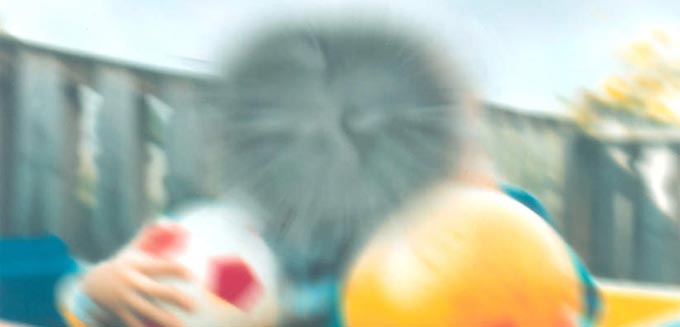 туман перед глазами