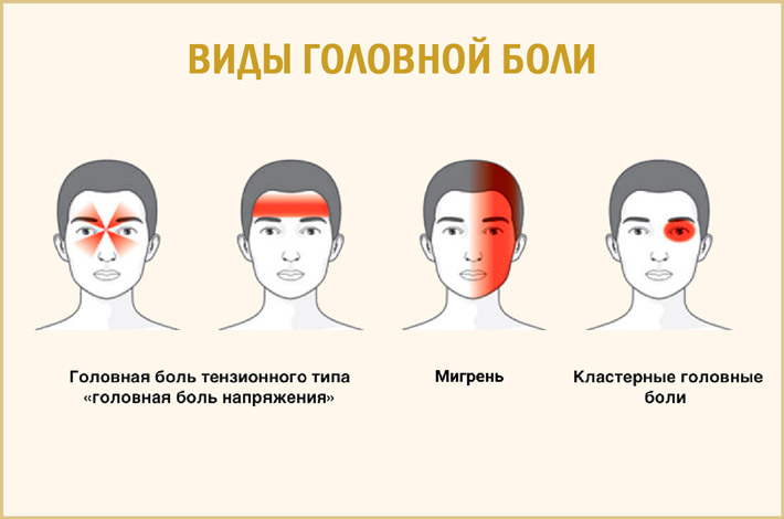 Виды головной боли