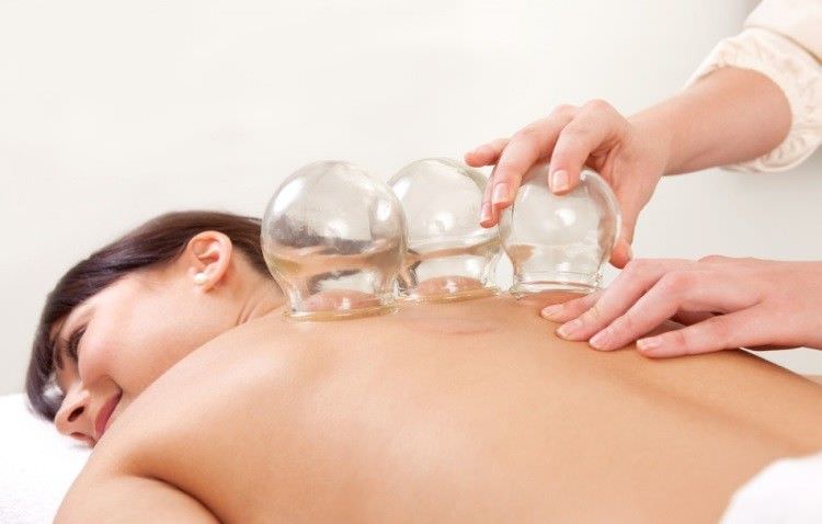 Постановка банок