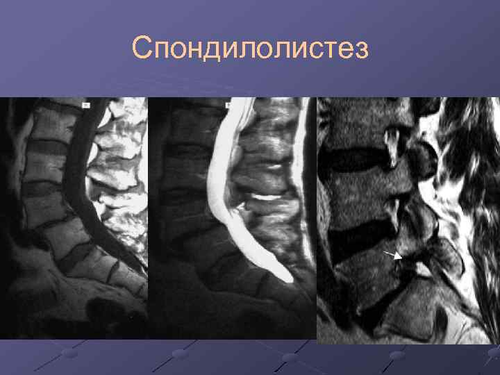 Когда сижу или лежу на спине болит копчик