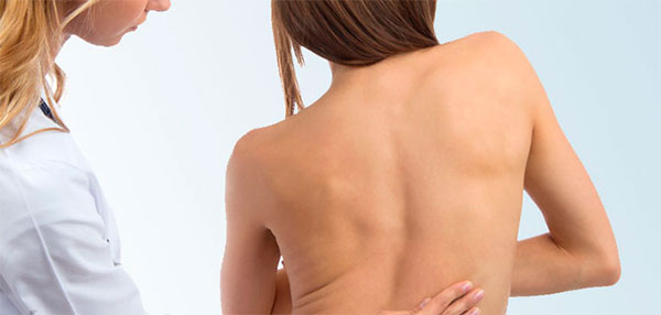 Осмотр спины специалистом