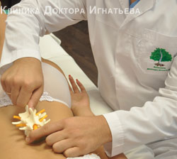 Межреберная невралгия лечение