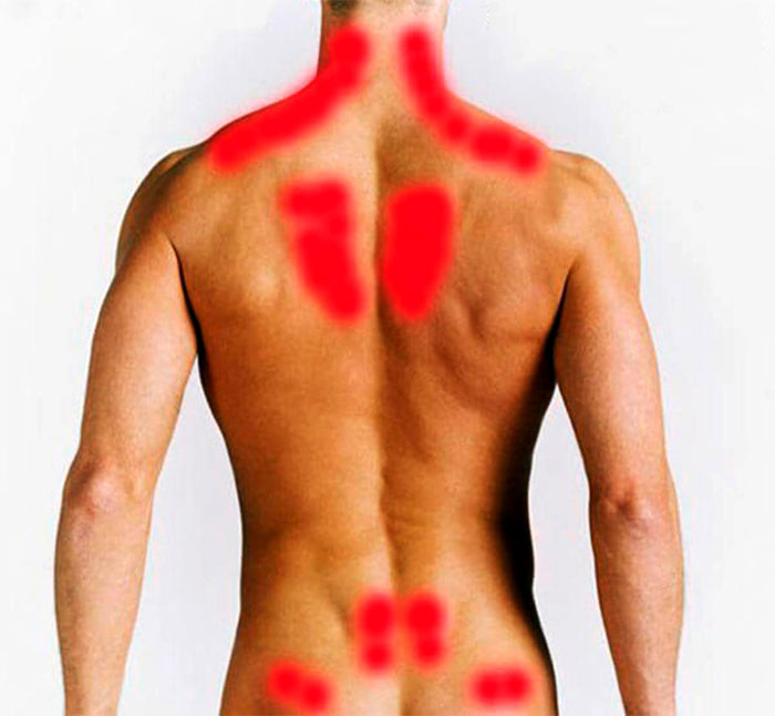 Зачем болит бок спины