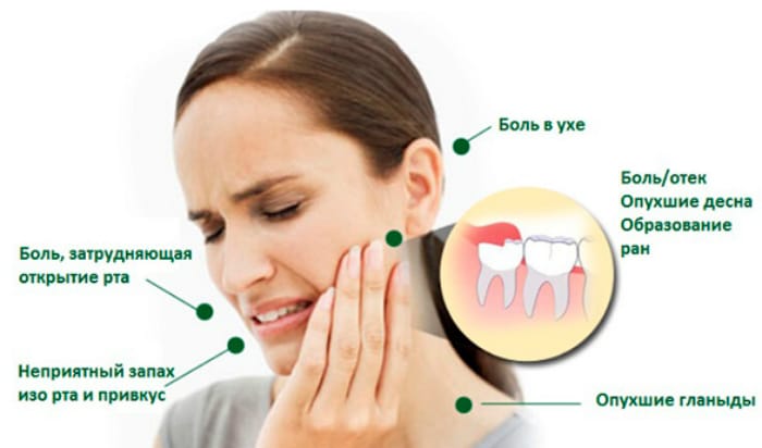 Неудобства причинённые зубной болью Неудобства причинённые зубной болью